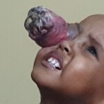 Help Dunya Einzelfälle